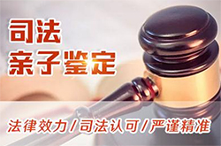 贵阳司法亲子鉴定准确可靠吗，贵阳司法DNA鉴定中心地址查询